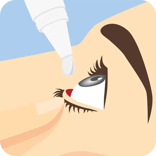 Close-up of the eye on a face; eye drop is about to drop into the pocket of the eye formed by the finger pulling back on the bottom eyelid.